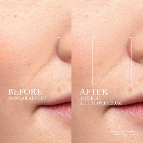 Lancôme Rénergie H.C.F. Triple Serum - Hyaluronic Acid Serum for Visible Correction of Anti Aging Signs & Dark Spots, With Vitamin C+, Niacinamide & Ferulic Acid, 50ml - Image 2