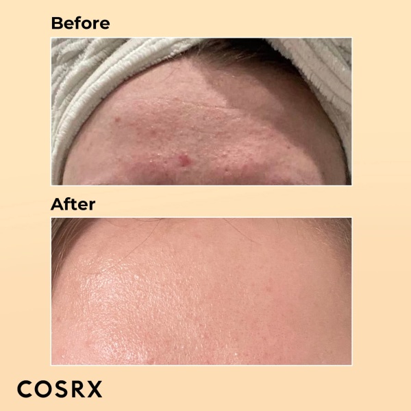 COSRX Advanced Snail 96 Mucin Power Essence 100ml, Skin Repair & Hydrating Serum, Snail Secretion Filtrate 96% & Hyaluronic acid, Korean Skincare, Animal testing free - Image 6