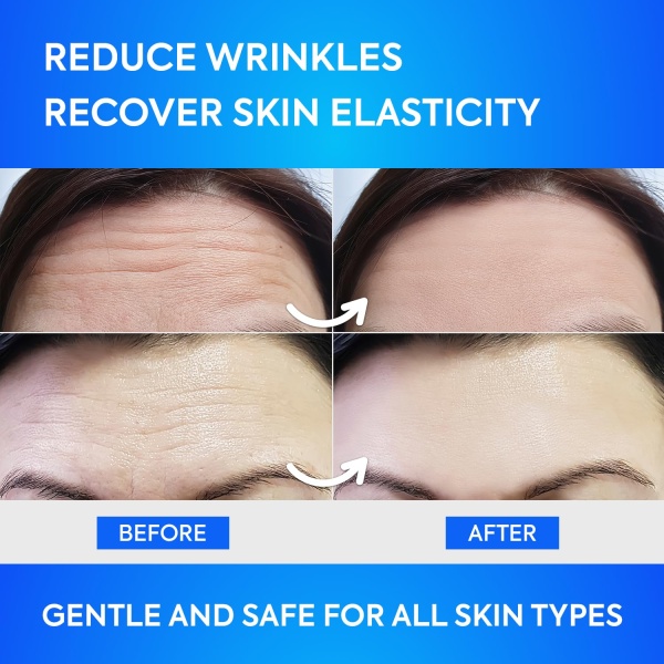 SILKDERMIS Forehead Wrinkle Patches, Moisturising Anti-Ageing Treatment, 12 Pcs - Image 3